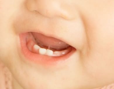 赤ちゃんの歯磨きから永久歯までの歯のお悩み聞きます 赤ちゃんの歯磨きどうやってするの？ イメージ2