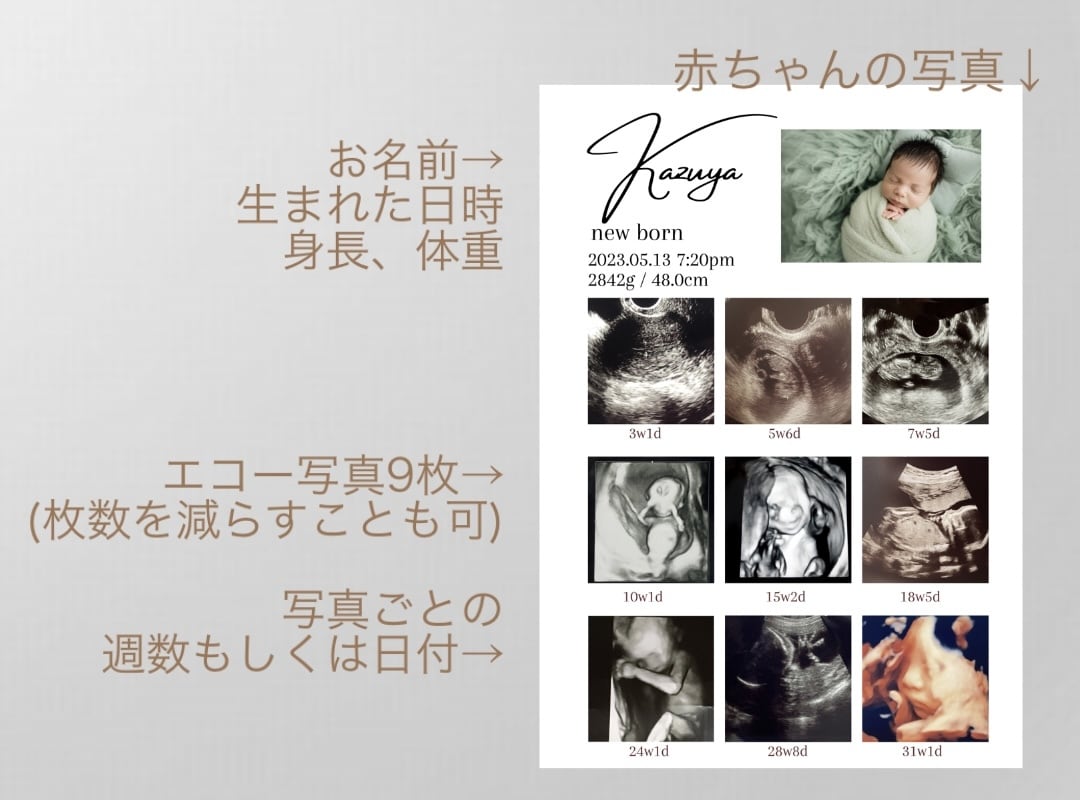 赤ちゃんの写真入りエコー写真ポスター作ります 大切な赤ちゃんの思い出をおしゃれに残しませんか？ イメージ7
