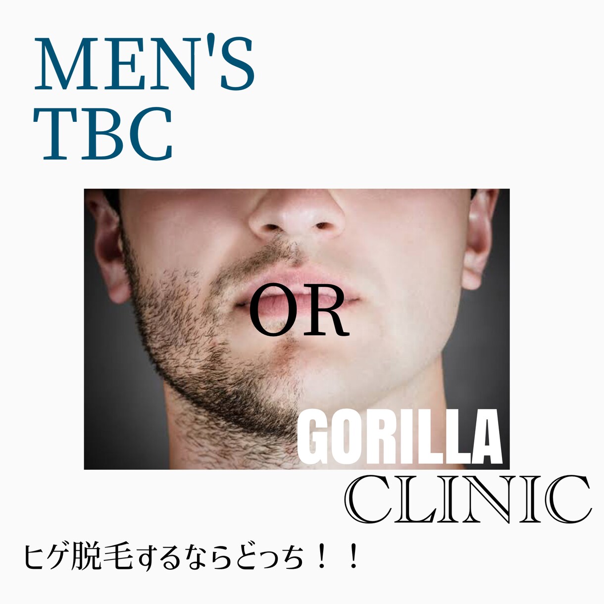 メンズ髭脱毛ならこっち！伝えます ヒゲ脱毛歴約2年 TBCとゴリラクリニック経験済み。 イメージ1
