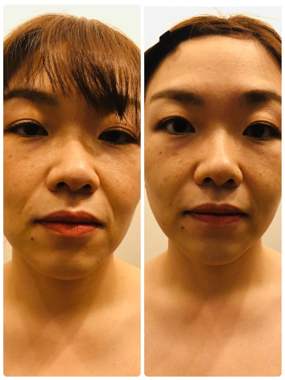 辛い肩首の凝りをほぐしスッキリとした小顔を叶えます たった5分で本当に綺麗になれる！輪郭シェイプケアマッサージ イメージ1