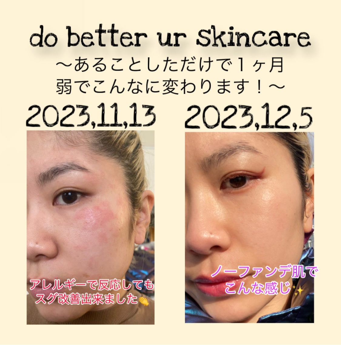 あなたのお肌の悩みを解決します 現状踏まえてケア方法とまたインナーケアのアドバイス イメージ1
