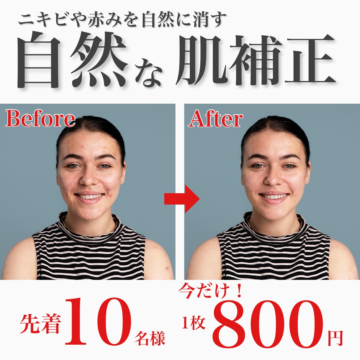肌補正｜ニキビ・赤みを自然に消します ニキビ・赤みを自然に消します｜やりすぎない清潔感レタッチ イメージ1