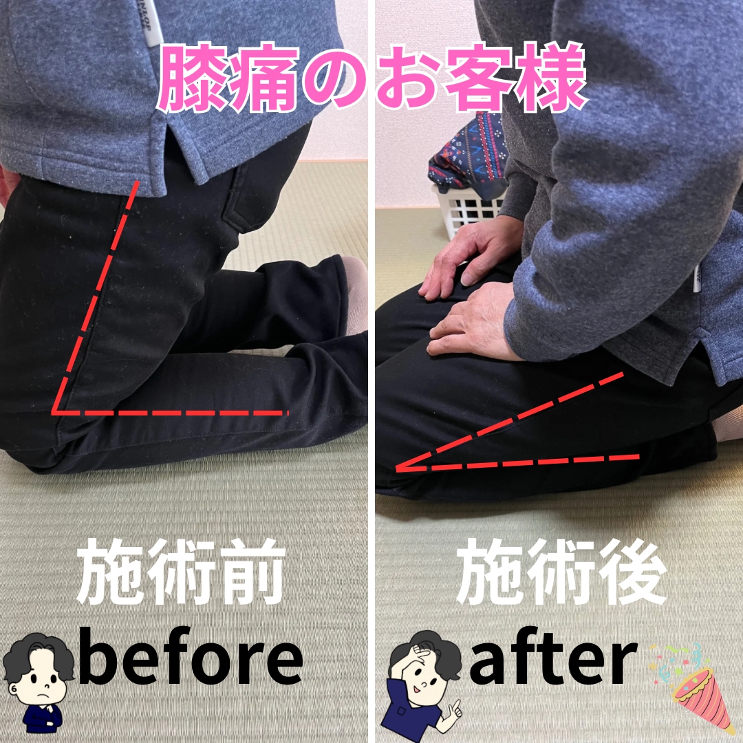 膝痛肩こりがある方に簡単セルフエクササイズ教えます サボり筋を単独収縮させる、革命的エクササイズをお伝えします！ イメージ2