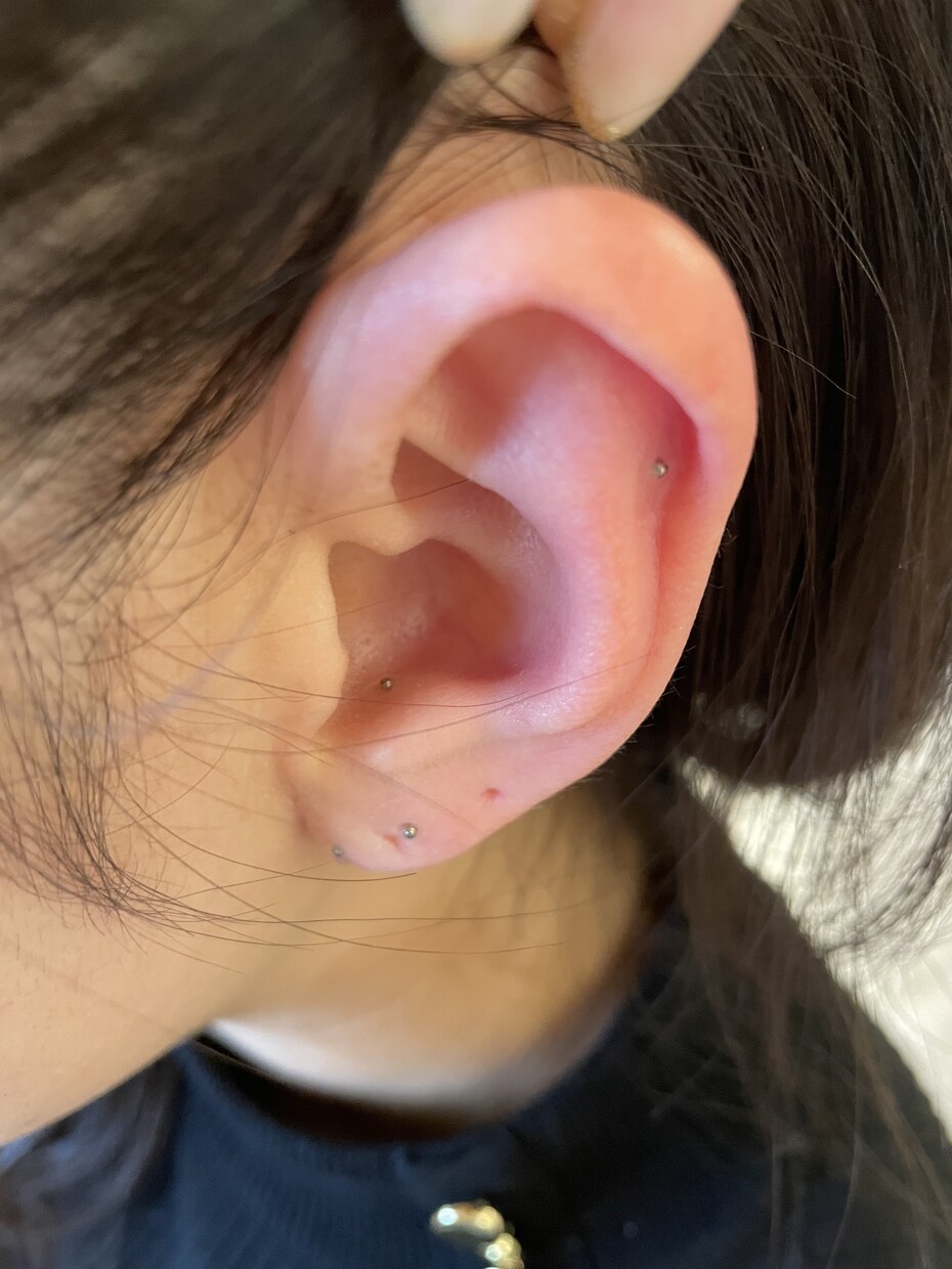 耳ツボ　体の不調な部分のツボお教えします 耳ツボセラピストです♪不調を改善しましょう。 イメージ1