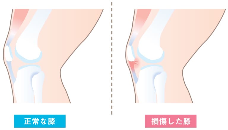 分かりやすい！伝わる！図解・解説イラスト制作します 整形外科・歯科・美容外科様など様々な図解イラストを作成 イメージ10