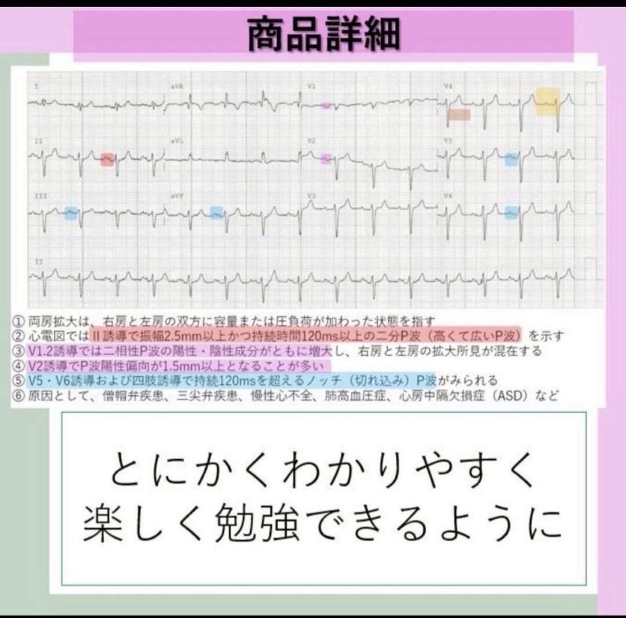 心電図検定3級勉強資料セットをお売りします 心電図検定1級取得者が作成した3級試験対策セット！ イメージ3