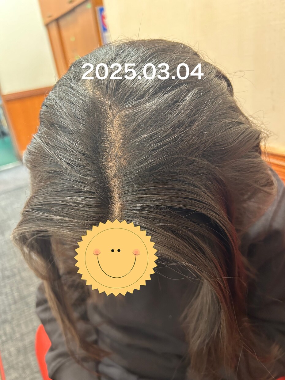 抜毛症専門！あなたの苦しみに寄り添います 私の経験談を詳しくお話します。 イメージ6