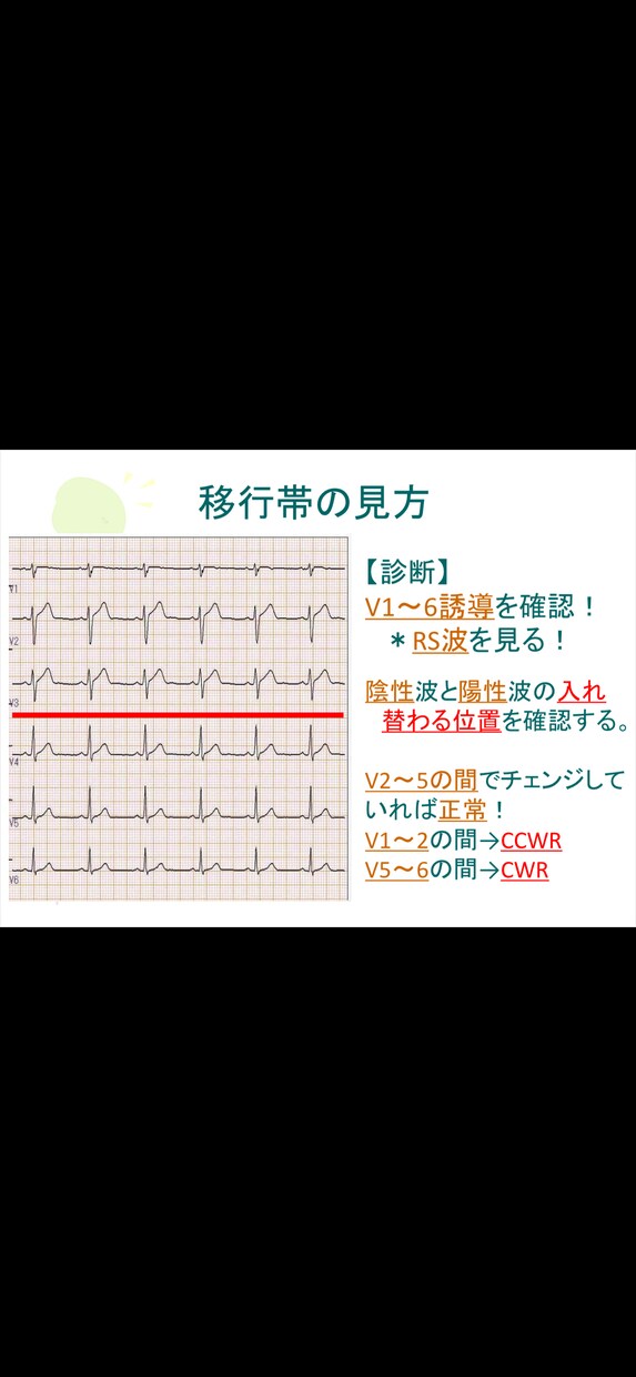 心電図の基礎を伝授します 心電図の基礎的な知識をまとめた資料を配布します！ イメージ1