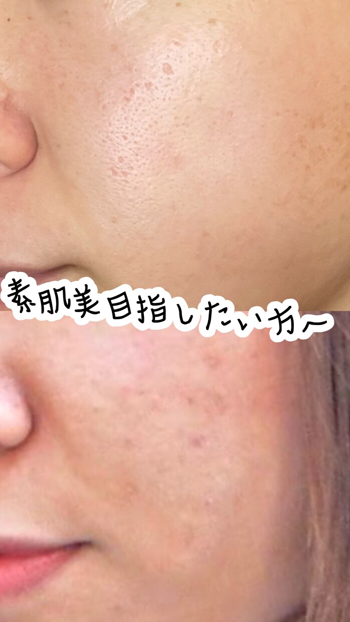 現役ビューティーアドバイザーがカウンセリングします 何がいいの？どうしたらいいの？お肌の疑問解消いたします！ イメージ1