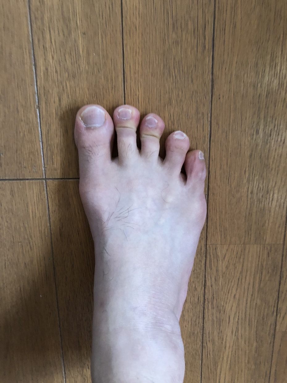 足の悩みが楽になります 。立ち姿勢の工夫や簡単なエクササイズで快適な生活に❗️ イメージ1