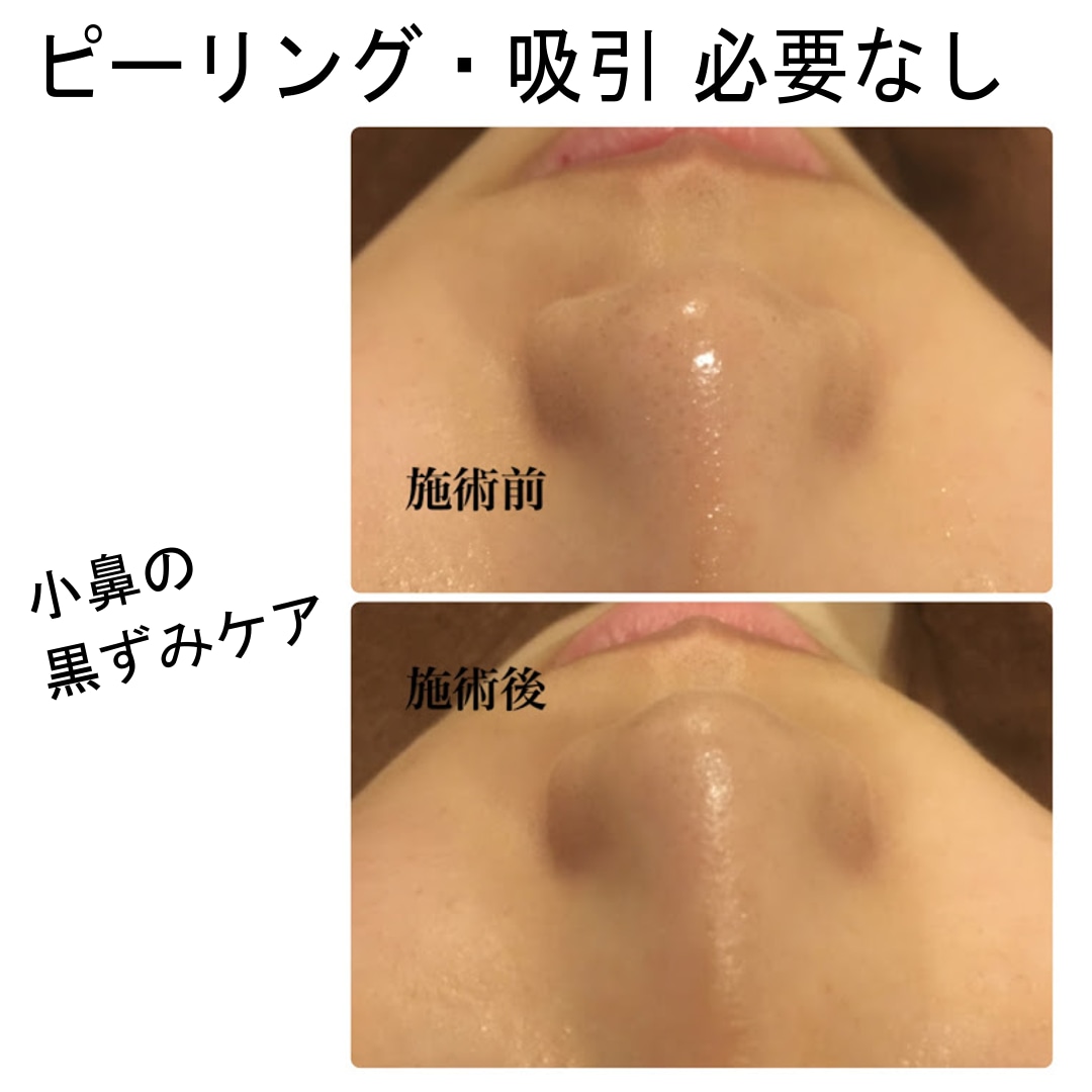 超敏感肌・アトピー肌のホームケをお教え致します ひとりひとりの生活に合わせたホームケアとスキンケアをご紹介 イメージ3