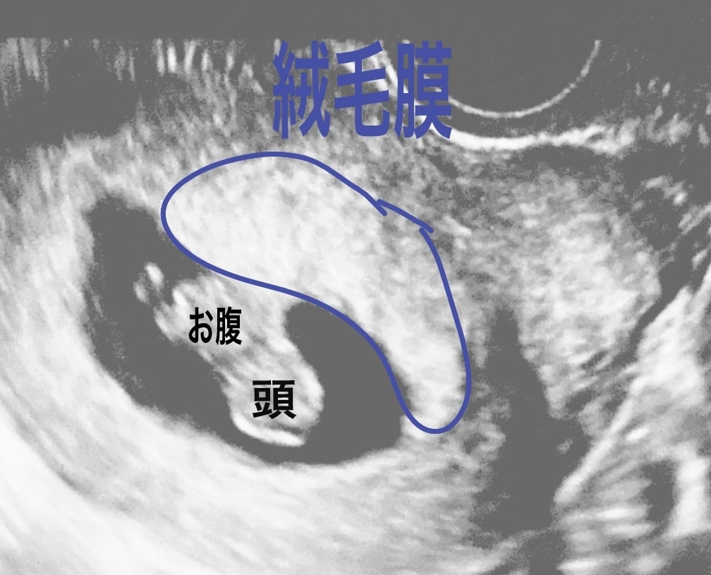 エコーにて最速妊娠6週からの性別予測をします 産婦人科、超音波専門医がラムジーメソッドにて性別予測！ イメージ2