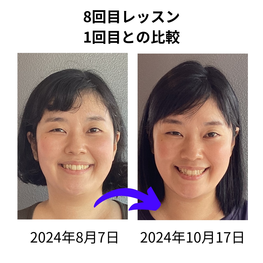 整形いらず！1日5分♡お顔の正しい筋トレ教えます 1日5分のセルフケアで整形いらず！自分で創る、理想の美顔♪ イメージ4