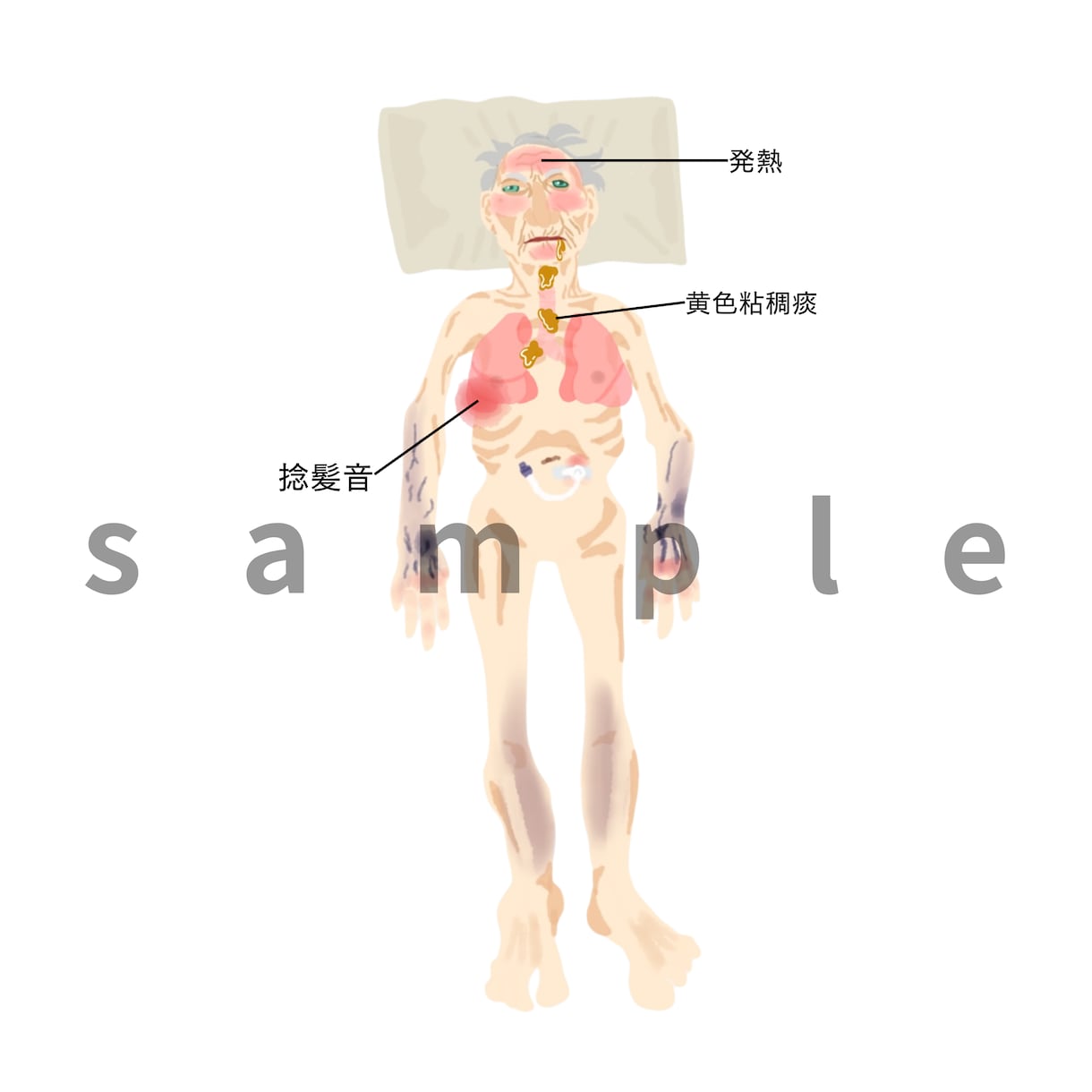 医療をわかりやすく図解イラスト作成します 勉強と臨床のズレを埋める医療ビジュアル制作します イメージ1