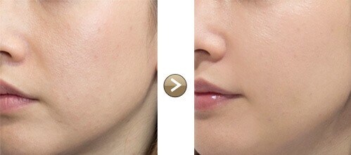 ニキビ跡シワ色黒乾燥全てのお悩みをサポートします 美容学校卒業・デパコスBA直伝のあなただけの美肌レシピ イメージ1