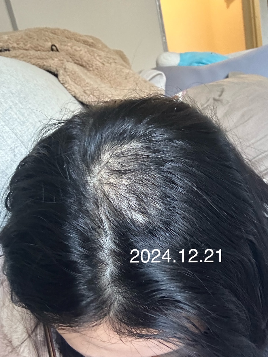 抜毛症専門！あなたの苦しみに寄り添います 私の経験談を詳しくお話します。 イメージ3