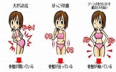骨盤の歪みを整えます Ｏ脚、Ｘ脚、腰痛、肩こり、下半身太りなどを改善したい方へ！ イメージ2