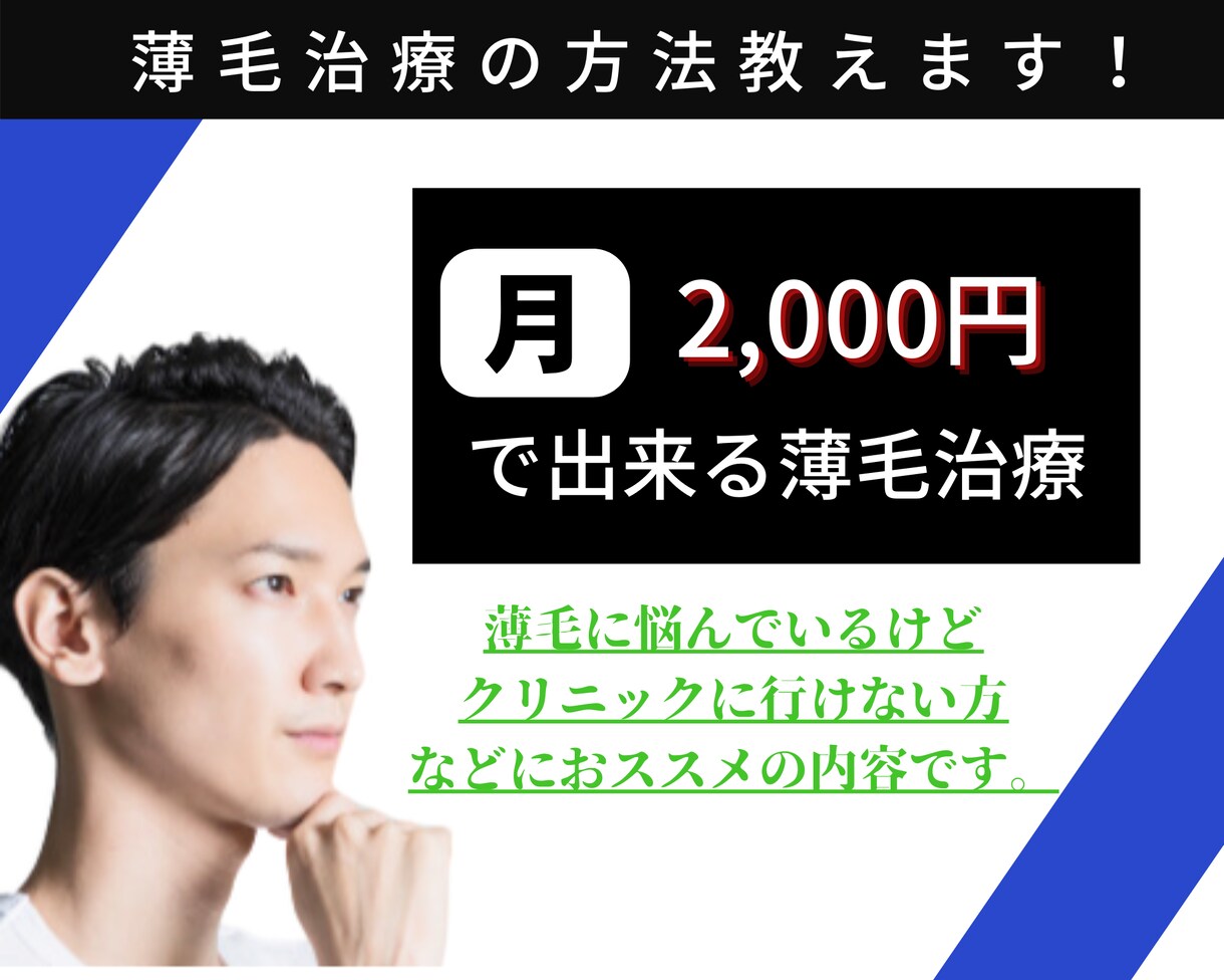 薄毛に悩む方に！薄毛対策教えます 〜思ってたよりも安く薄毛対策出来ます〜 イメージ1