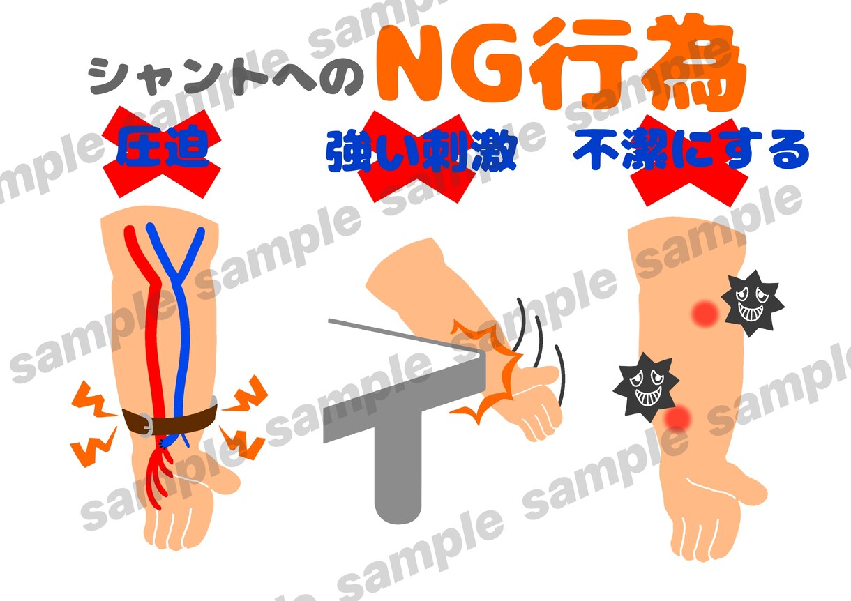 透析患説明がラクになる図解４枚セット作成します ３秒で伝わる！患者説明を楽にする図解 イメージ5
