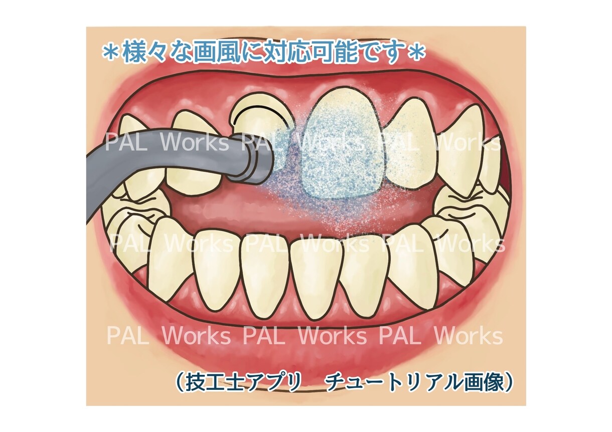 芸大卒•現役歯科衛生士が歯科イラストを描きます ブログ・学会などに！専門用語や細かい指示にも対応できます！ イメージ6