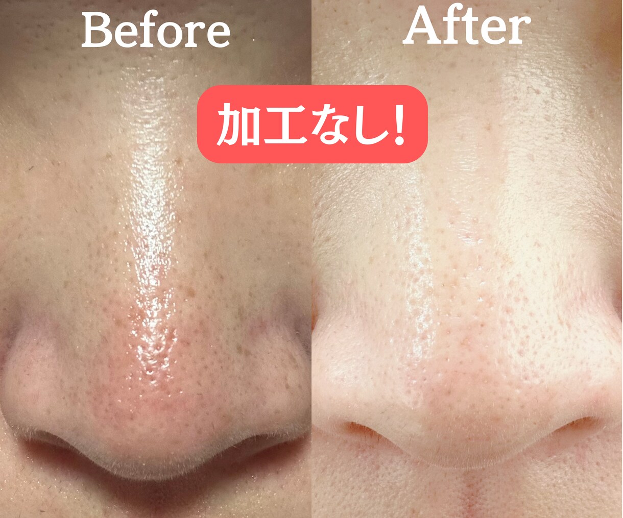 チャットで肌改善 個別相談（最大3日間）ができます 肌は十人十色！目指すはノーファンデ！ イメージ2
