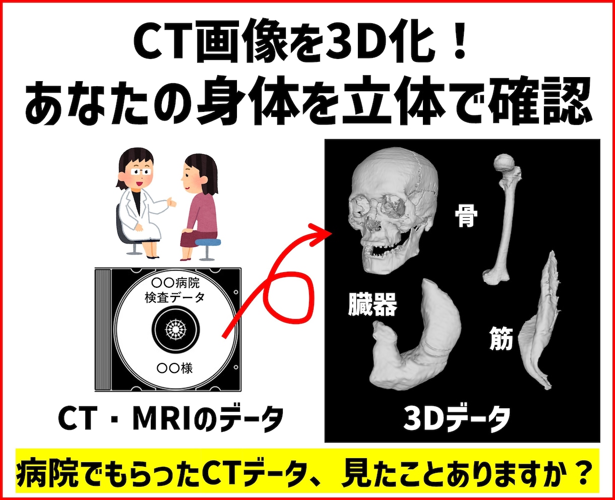 CT画像を3D化！あなたの身体を立体で確認できます 病院でもらったCTデータ、見たことありますか？ イメージ1