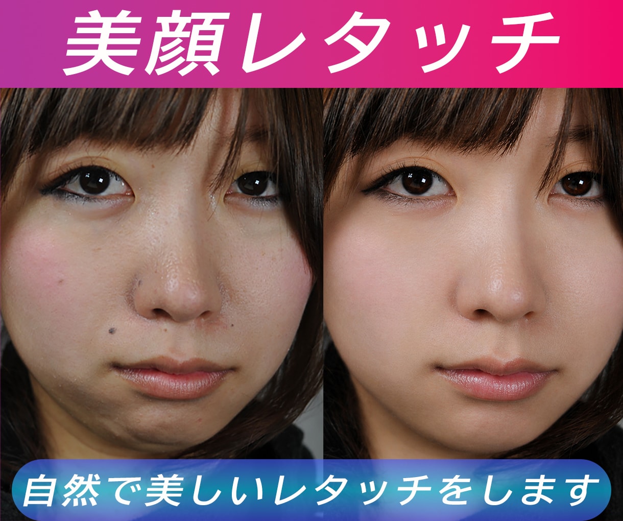 自然で美しいレタッチをします ホクロ・あざ・しわなどを除去しお肌を滑らかにレタッチします。 イメージ1