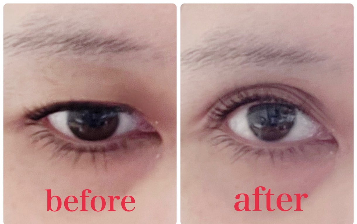 整形なしで二重にする方法教えます 分厚い一重瞼から二重にした実体験を伝授します。 イメージ1