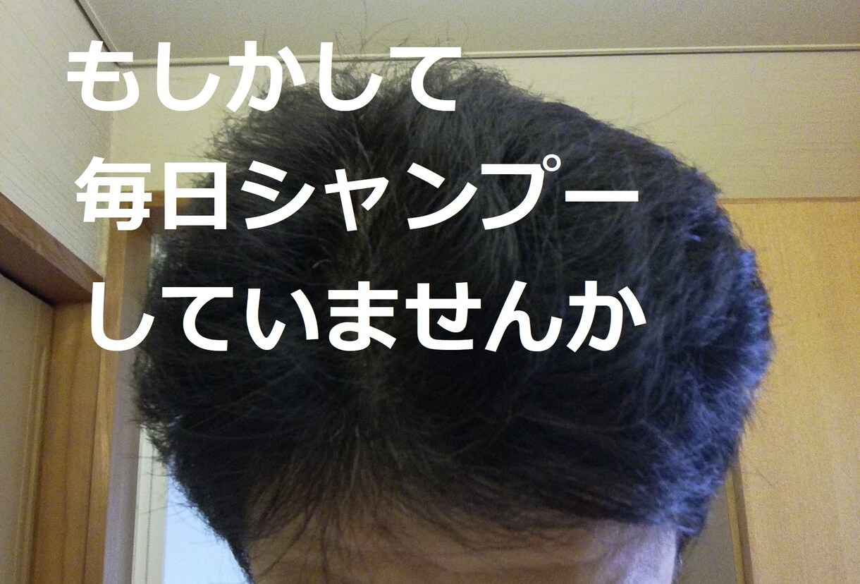抜け毛減！薄毛ハゲにならない髪の洗い方を伝授します 毎日シャンプーしなくてもいい頭皮に優しい洗い方 イメージ1
