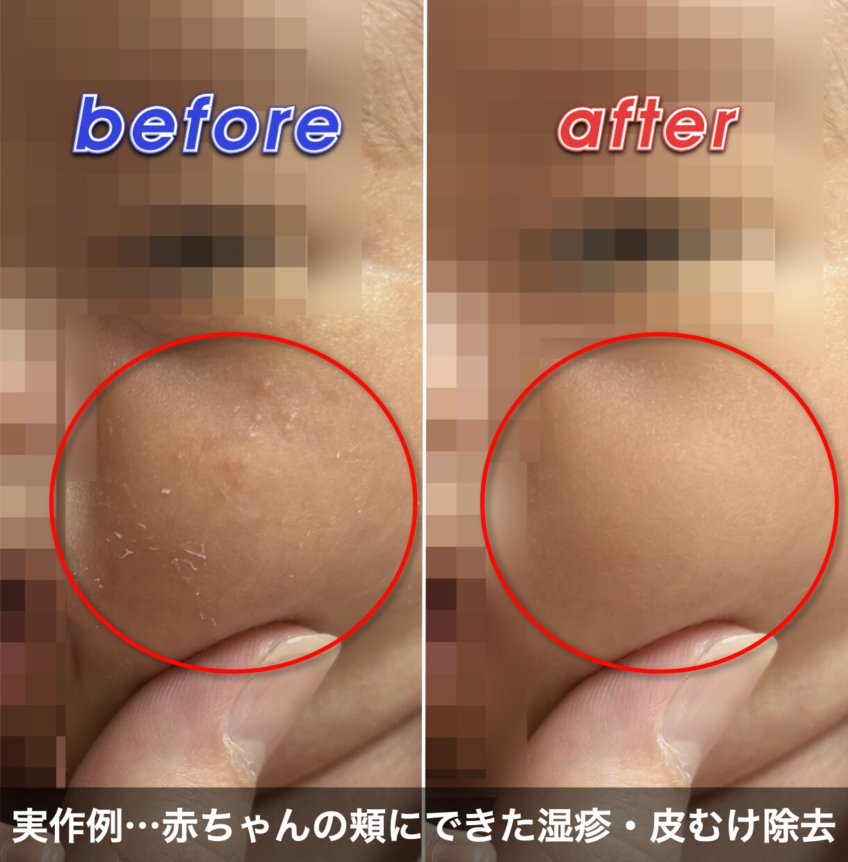 無料サンプルで仕上がりを確認後にご購入いただけます 顔写真に特化した、拡大しても補正の分からない繊細なレタッチ! イメージ6