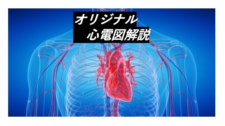 心電図のご質問に専門医が回答します 心電図に関する具体的なオリジナル回答を得ることができます。 イメージ1