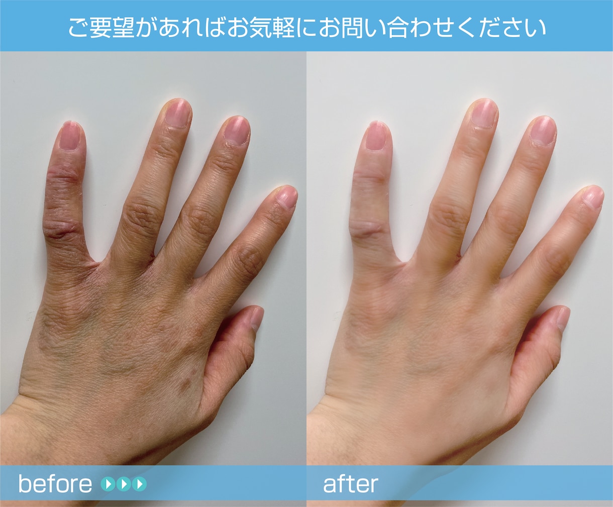婚活写真などの宣材写真を綺麗に補正いたします 宣材写真を補正して良縁のお手伝いします！ イメージ4
