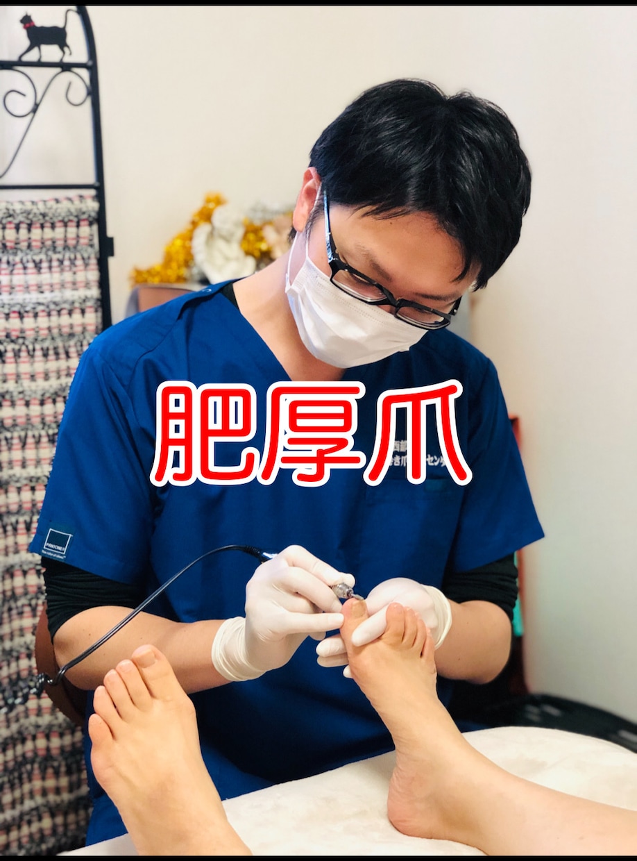 💬Coconara｜Currently accepting reservations A proven professional will speak to those who are worried about thickened nails Ingrown nail foot meister...