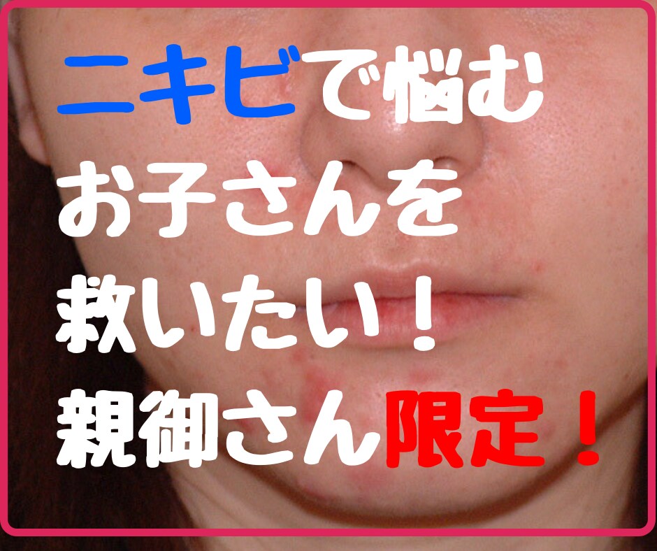 お子さんのお肌の悩み解決します のべ1000人以上を美肌に導いてきた美肌マジシャンの美肌術 イメージ1