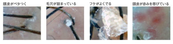 髪の抜け毛。育毛の100記事を提供します 髪の抜け毛。育毛の悩み格安2000円 イメージ1