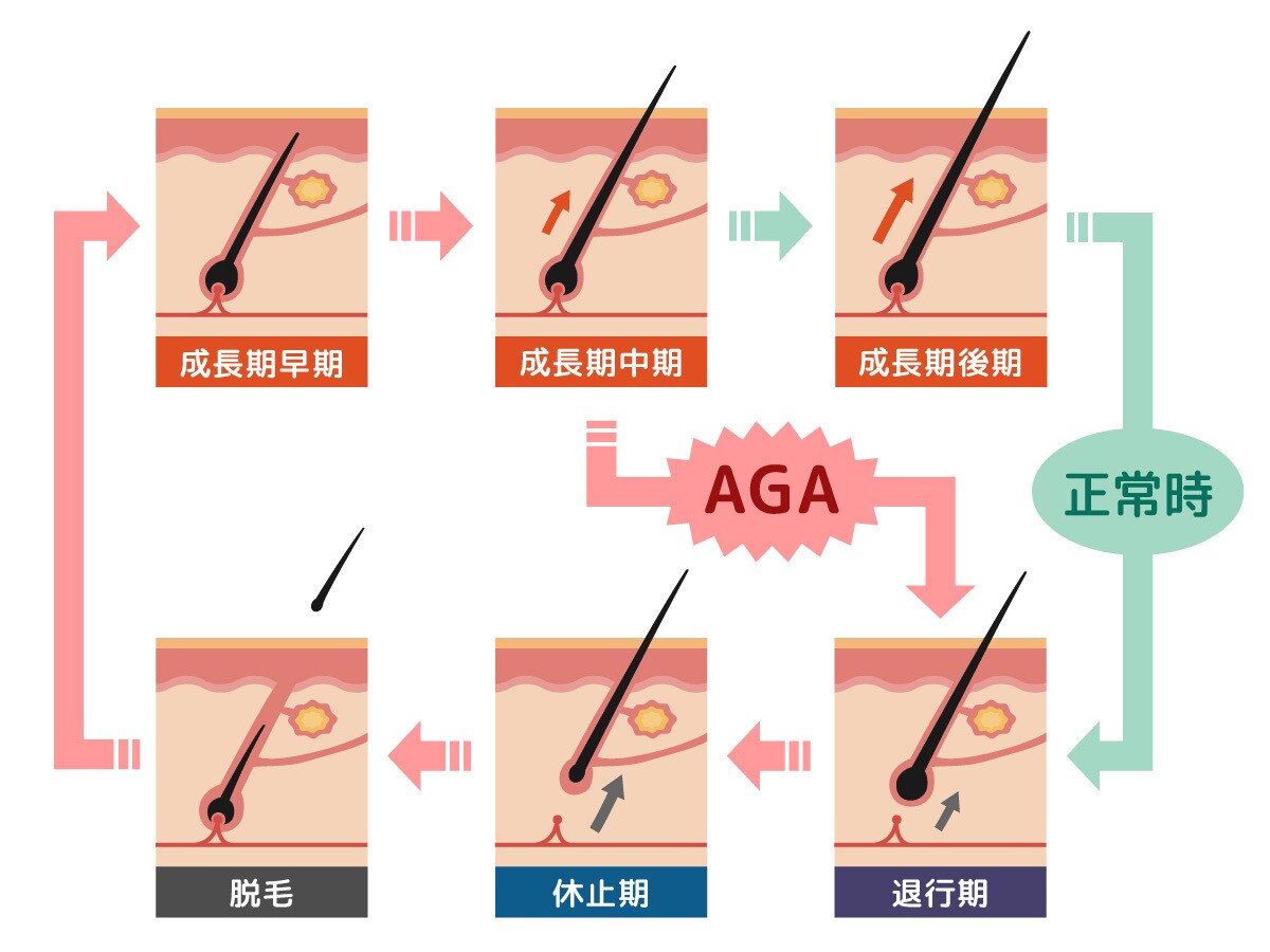 育毛・美髪相談にのります ６か月で30％の髪の増量に成功した整体師がアドバイス イメージ6