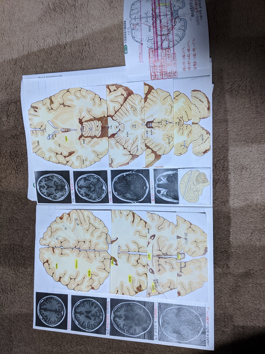 猫背！腰痛！肩凝！姿勢から解消します 認定理学療法士が【身体の不均衡】を医療知識で解消します！ イメージ10