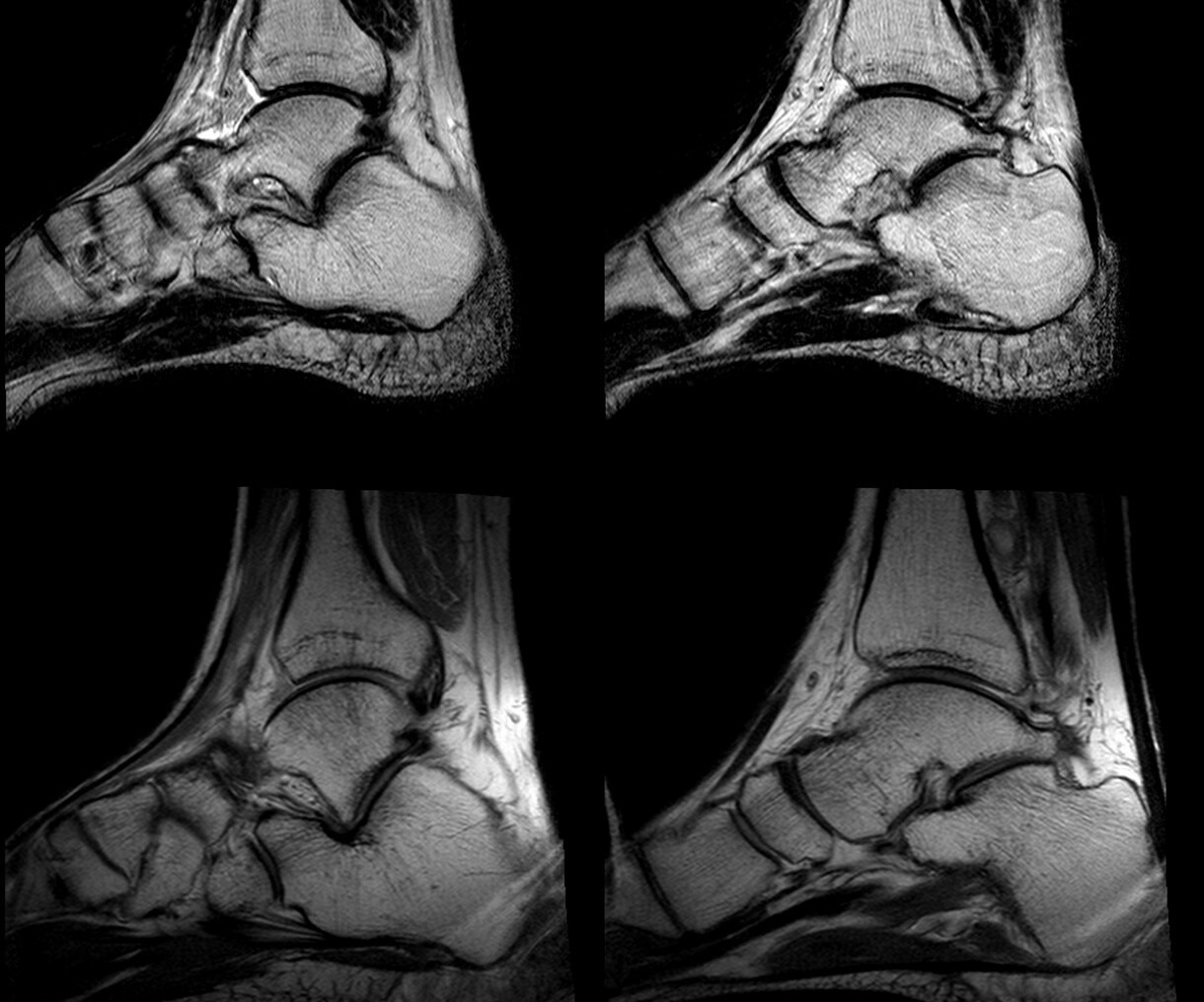 足首の捻挫を頻繁に繰り返す強化プログラム作成します 何度も繰り返し捻挫する問題には必ず原因があり〇〇を強化する事 イメージ6