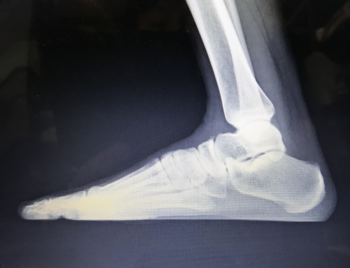どこを揉んだら楽になるの？不調部分別に教えます 体が楽になる隠れた秘密部分を教えてしまいます。 イメージ4