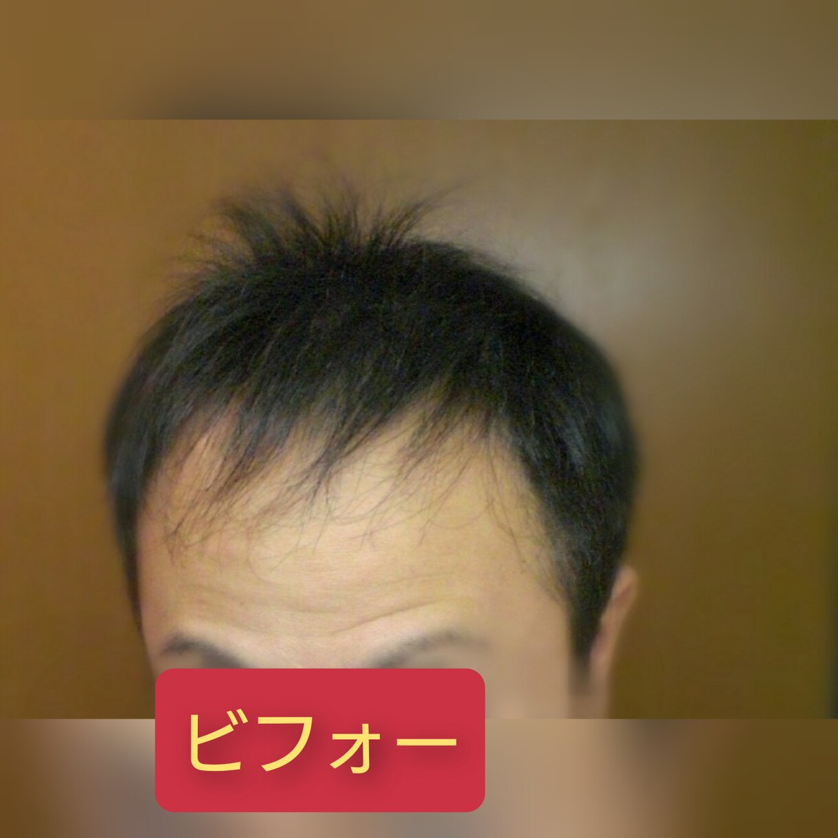 薄毛を克服した体験談を提供致します 薄毛は改善できます！私はハゲの悩みから解放されました！ イメージ2