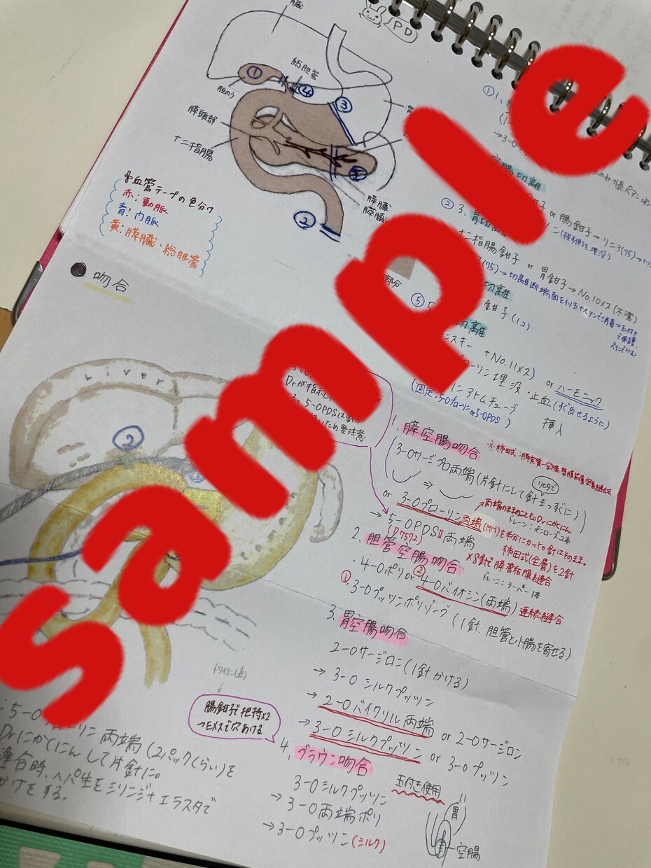 消化器外科手術手順書お渡しします 自己学習サポート！外科手術の理科深まる！ イメージ7