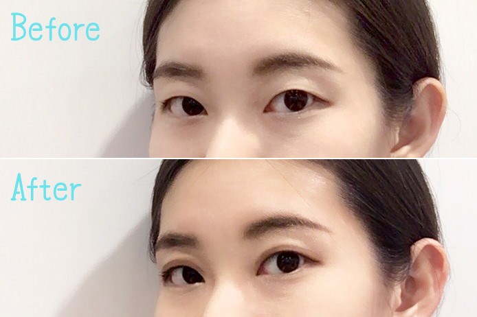 二重になる方法伝授します 一重から二重に！モテるために！かっこよくかわいくなるために！ イメージ1