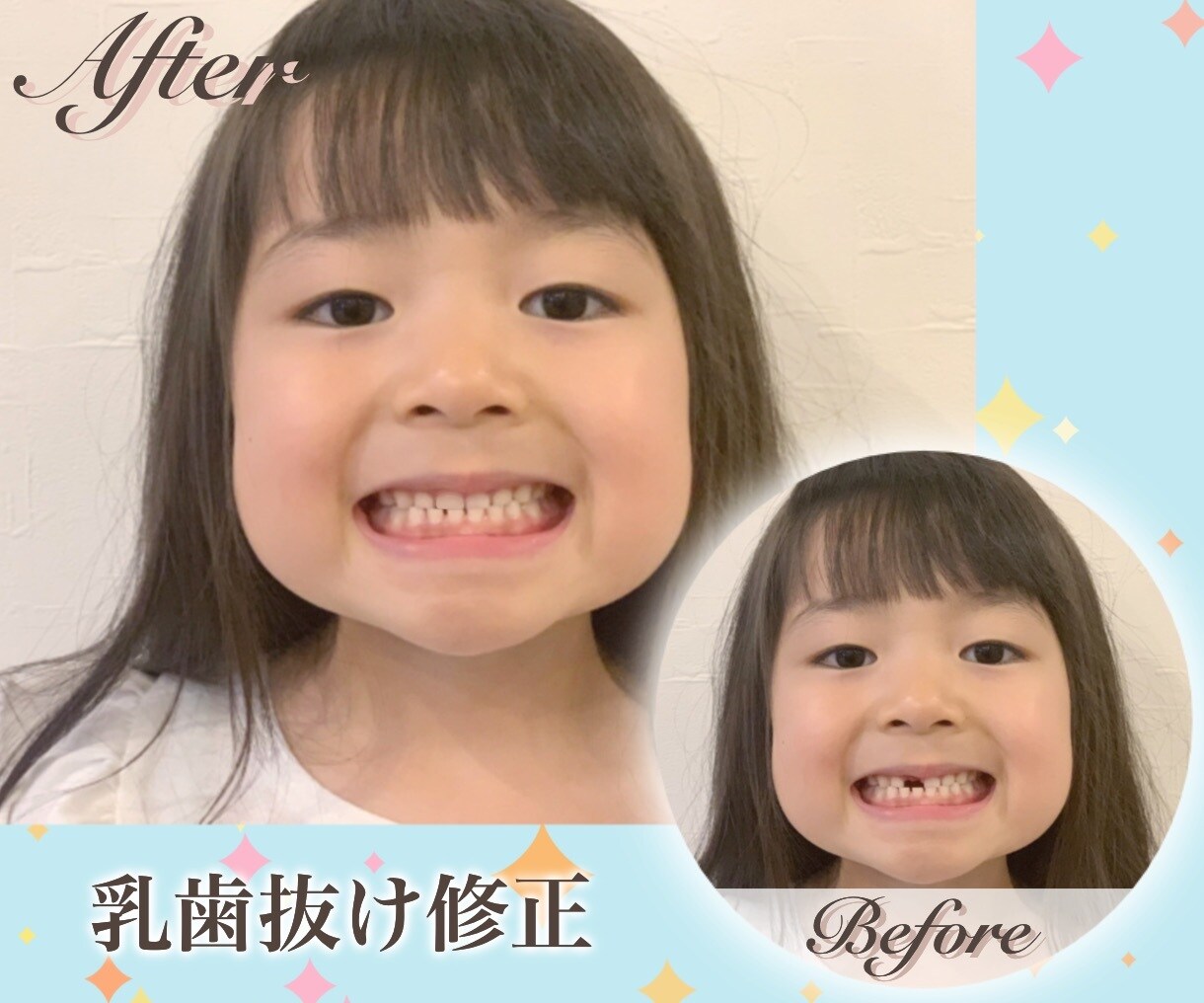思い出の写真をナチュラルに美しく補正いたします ナチュラル補正、メイク修正、歯抜け修正、髭削除、不用物削除… イメージ4