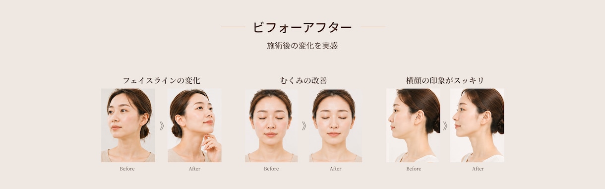 女性向け美容LPを制作します 女性向けデザインで集客導線まで設計します イメージ6