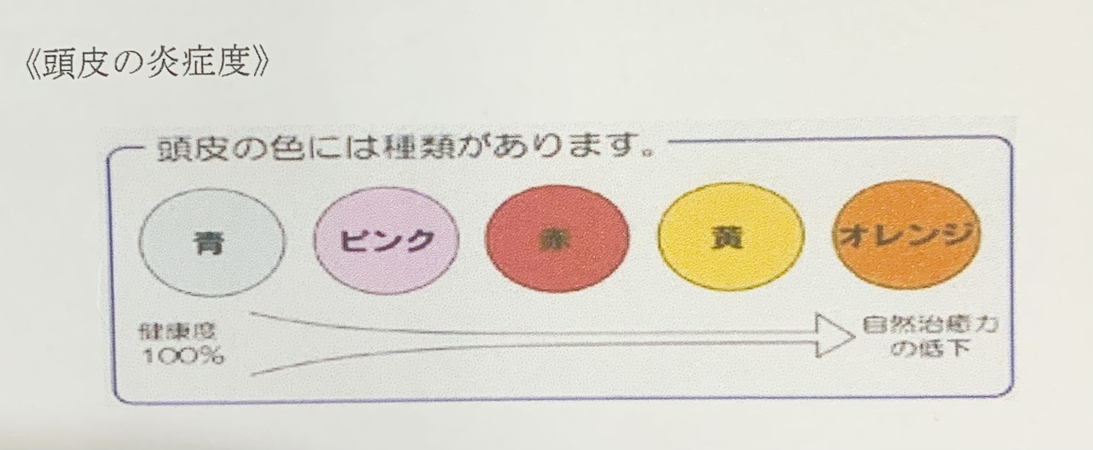 薄毛のあなたに寄り添います 本気で悩んでいる方へ！最後の砦としてご活用下さい。 イメージ3