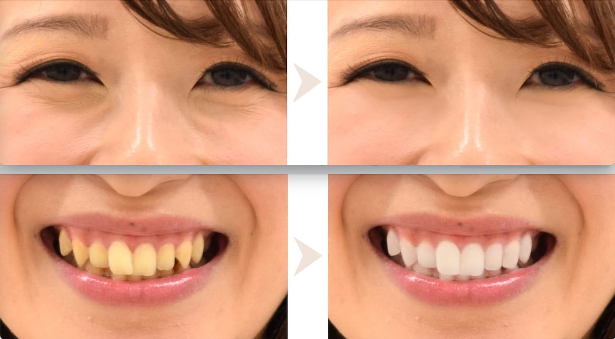高品質・ハイスピード・低価格で画像加工いたします 大手通販会社様/某アイドルグループ/遺影写真など実績多数！！ イメージ9