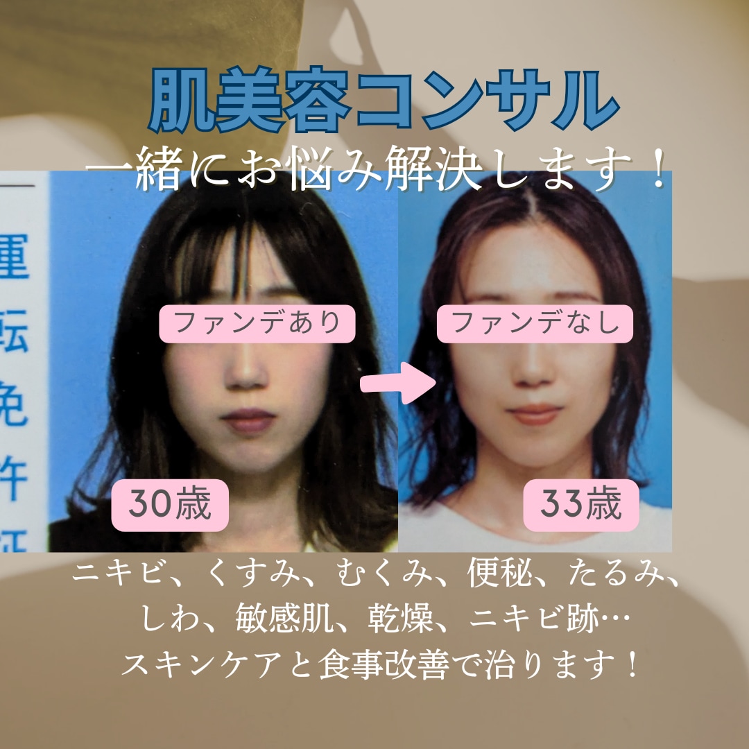 しわ,ニキビ,たるみ…あなたのお肌悩みを解決します 14年目セラピストが、あなたのためのスキンケアと食事を提案 イメージ1