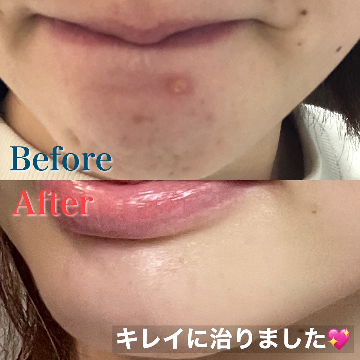 お金をかけずに手持ちアイテムで最大限美肌に導きます 化粧品を買い足さなくても美肌は作れます♡１０日間でハリ透明感 イメージ2