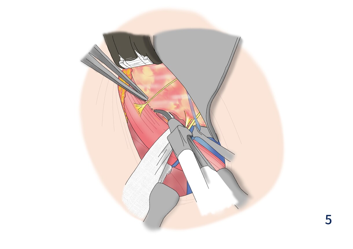 医療従事者の方オススメ！医療系の挿絵制作します 学会やプレゼンで使う資料の挿絵採用実績あり イメージ3