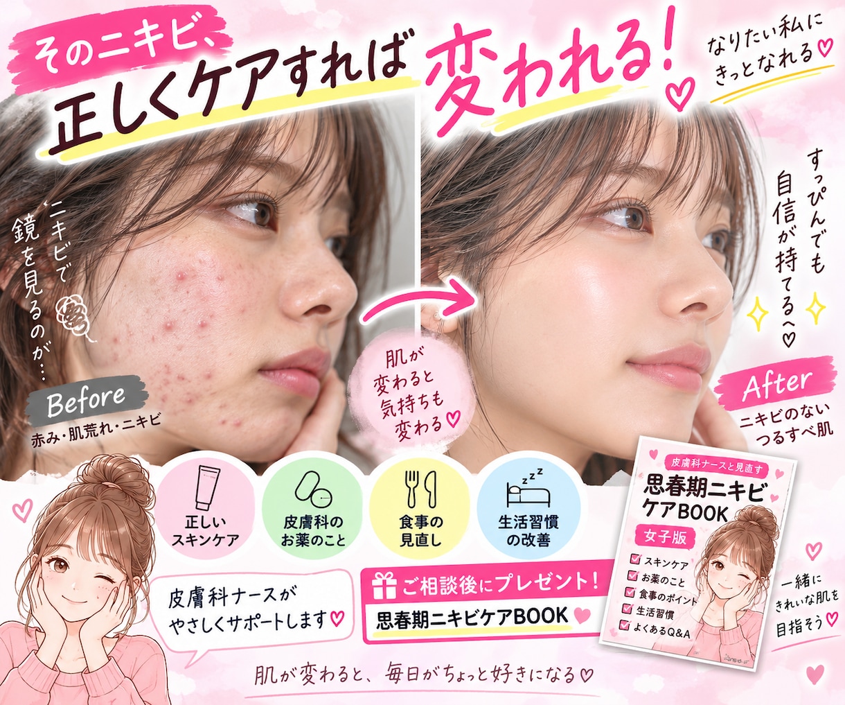 皮膚科ナースがニキビ、肌荒れのご相談のります 繰り返すニキビ一緒に原因を整理しませんか。特典付き♡ イメージ3